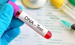   DNA Test -- Paternity of Child -- Exceptional Circumstances 